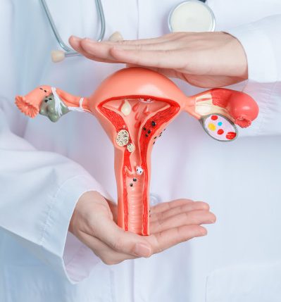 Posso engravidar com mioma? Tipos e impactos na gestação