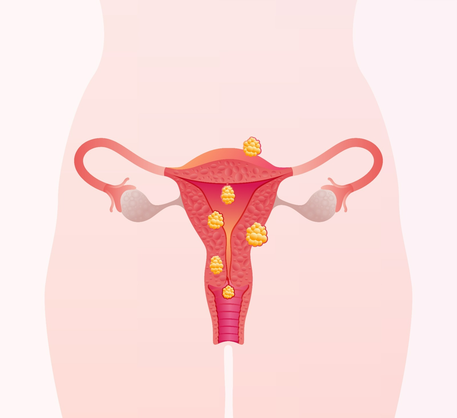 quando investigar antes de engravidar