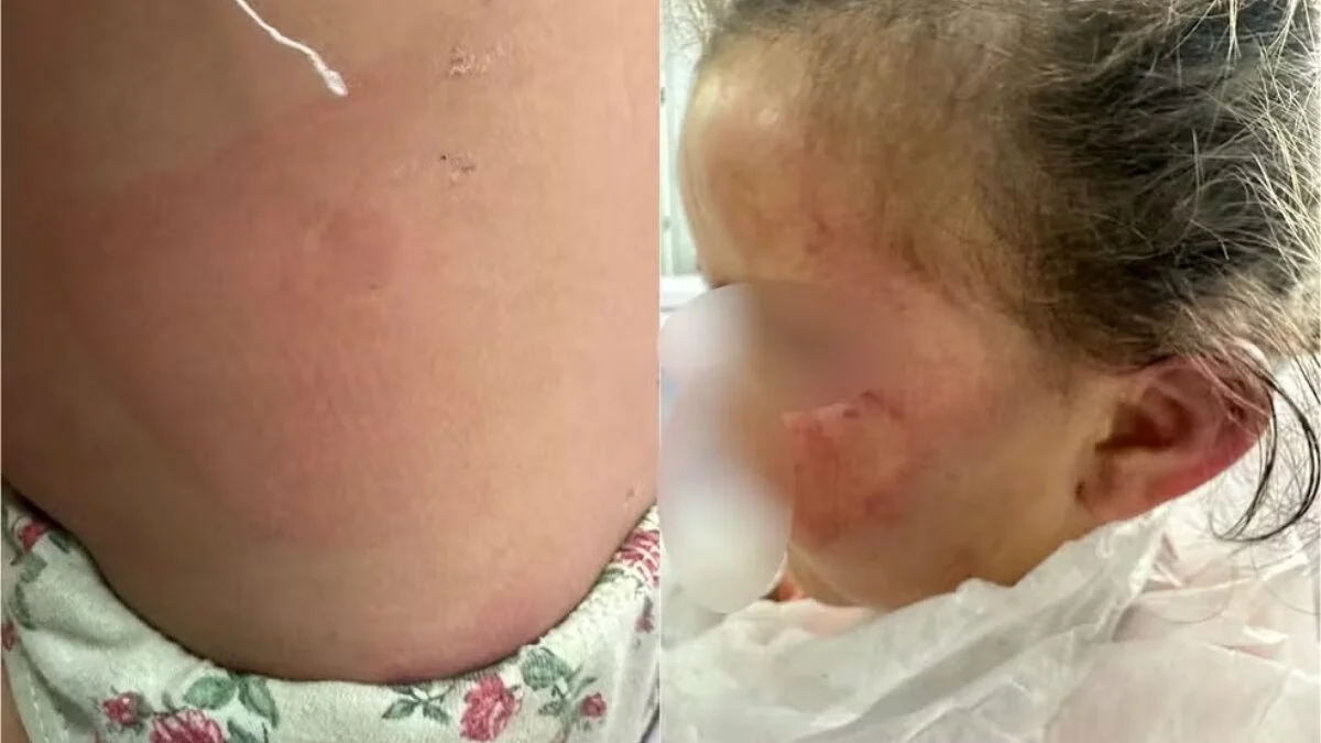 Criança de 3 anos é espancada pela mãe por sumir escova de cabelo em Goiás